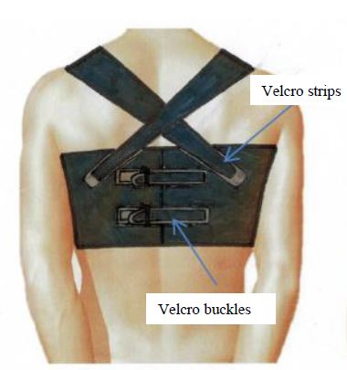 MONITORIA (Monitoring NonInvasively To Overcome mortality Rates of heart  Insufficiency on Ambulatory)